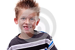 Cute young boy smiling and missing teeth