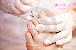 Cuticle treatment for pretty and clean toenails, menÃ¢â¬â¢s pedicure toenail concept photo