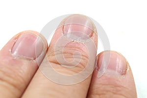 Cuticles macro