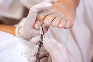 Cutting of nail edges, hangnails and cuticles on toes
