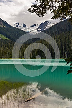 Cyan-turquoise waters of Lower Joffre Lake reflect forested mountains