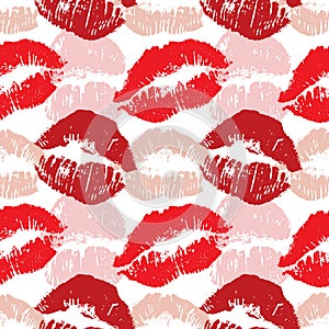 Cyclic kiss background