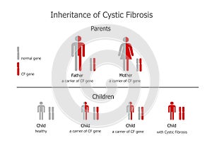 Cystic Fibrosis (mucoviscidosis) - inheritance photo
