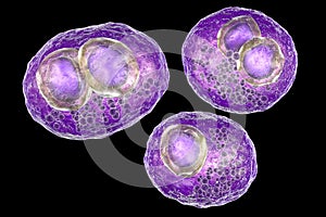 Cytomegalovirus CMV inside human cell, owl`s eye inclusion in the nucleus, multinucleated cell, 3D illustration