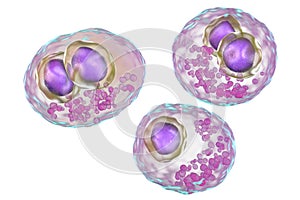 Cytomegalovirus CMV inside human cell, owl`s eye inclusion in the nucleus, multinucleated cell, 3D illustration photo