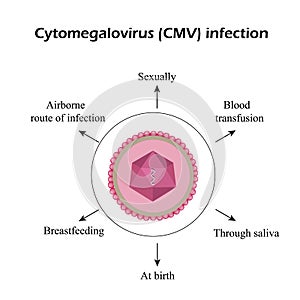 Cytomegalovirus. Diseases caused by cytomegalovirus. Infographics. Vector illustration