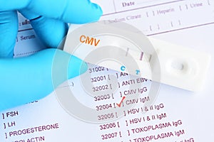 Cytomegalovirus positive test result