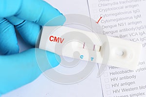 Cytomegalovirus positive test result photo