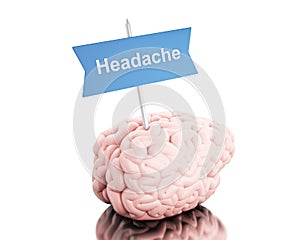 3d Brain with a signboard and word headache.