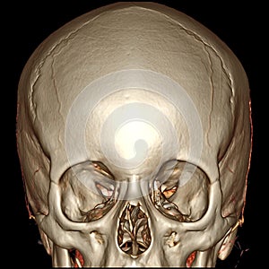 3D CT Brain Front View photo