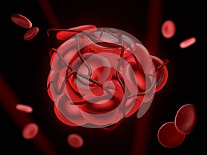 3d Illustration of illustration of a blood clot, thrombus or embolus with coagulated red blood cells. photo