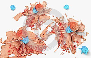 3d illustration of a cancer cell attacked and killed by lymphocytes photo