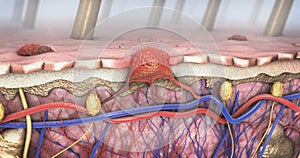 Attraverso sezione da malato pelle entra circolazione sanguigna un linfatico tratto 