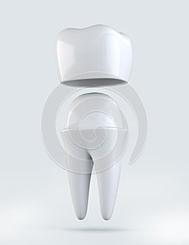 3D illustration of Crown tooth on white background.