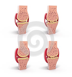 3d illustration of healthy and spherical synovial joint. photo