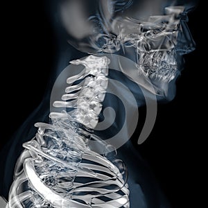3d illustration of human body skeletal cervical vertebra photo