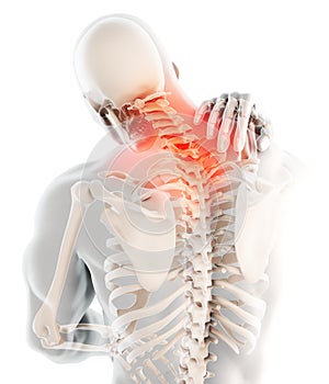 Neck painful - cervical spine skeleton x-ray, 3D illustration.