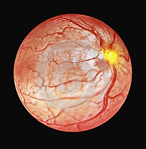 3d illustration of Optical Coherence Tomography OCT