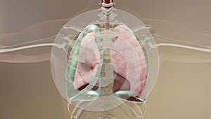 3d Illustration of Pneumothorax, Normal lung versus collapsed photo