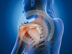 Painful shoulder joints. Frozen shoulder, impingement. 3d illustration photo