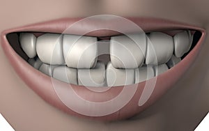 3d illustration of woman mouth full of strong white teeth with gap malocclusion smile photo