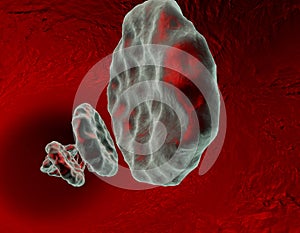 3d Infected blood vein