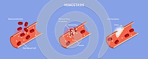 3D Isometric Flat Vector Conceptual Illustration of Hemostasis photo