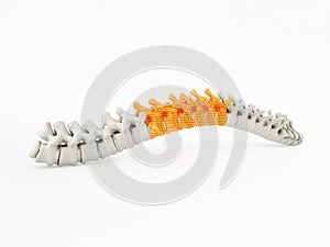 3d printed spine