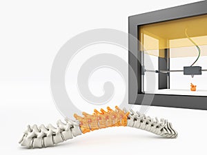 3d printed spine