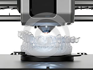 3d printer creating dental model