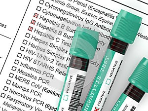 3d render of  blood samples with hepatitis test