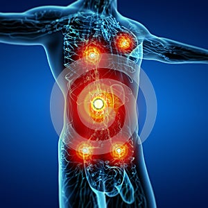 3D rendering illustration of Lymphatic system