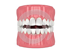 3d render of human jaw with black triangles