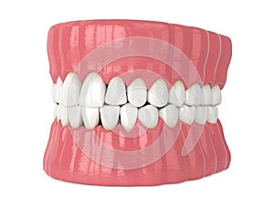 3d render of human jaw with black triangles