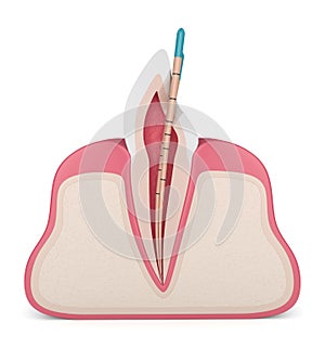 3d render of incisor tooth with gutta percha photo