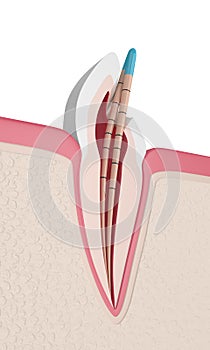 3d render of incisor tooth with gutta percha photo