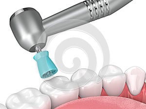 3d render of jaw with dental handpiece and polishing prophy cup photo