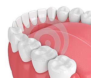 3d render of jaw model with teeth over white