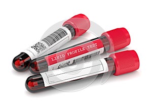 3d render with lipid profile test blood samples