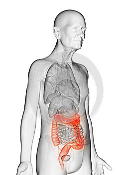 An elderly mans colon