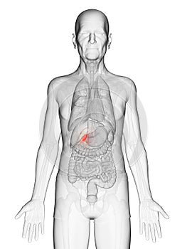 An elderly mans gallbladder