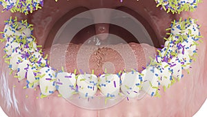 Bacteria on the teeth