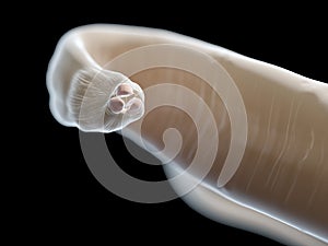 An ascariasis worm
