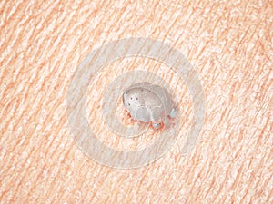 a scabies mite