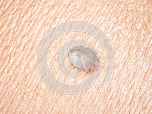 a scabies mite photo