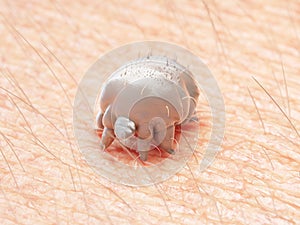 a scabies mite