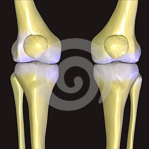 3d rendered illustration of skeletal knees with painful joints photo
