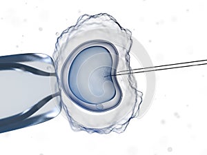 An invitro fertilization