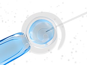 An invitro fertilization