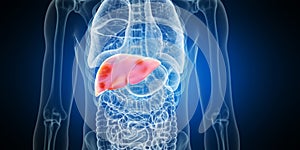 Liver tumors photo
